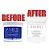 Anesi Lipoaminocel  - Ambalaj vechi - Ambalaj Nou